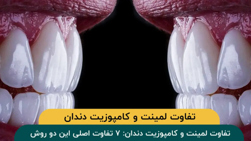 فرق-لمینت-و-کامپوزیت